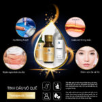 Tinh Dầu Vỏ Quế (Cinammon Back Essential Oil) - Ảnh 3